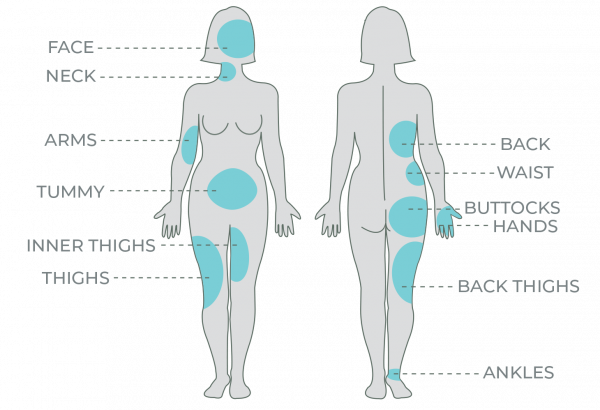 body-map.png